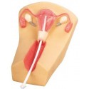 IUD PLACEMENT TRAINING SIMULATOR (SOFT)